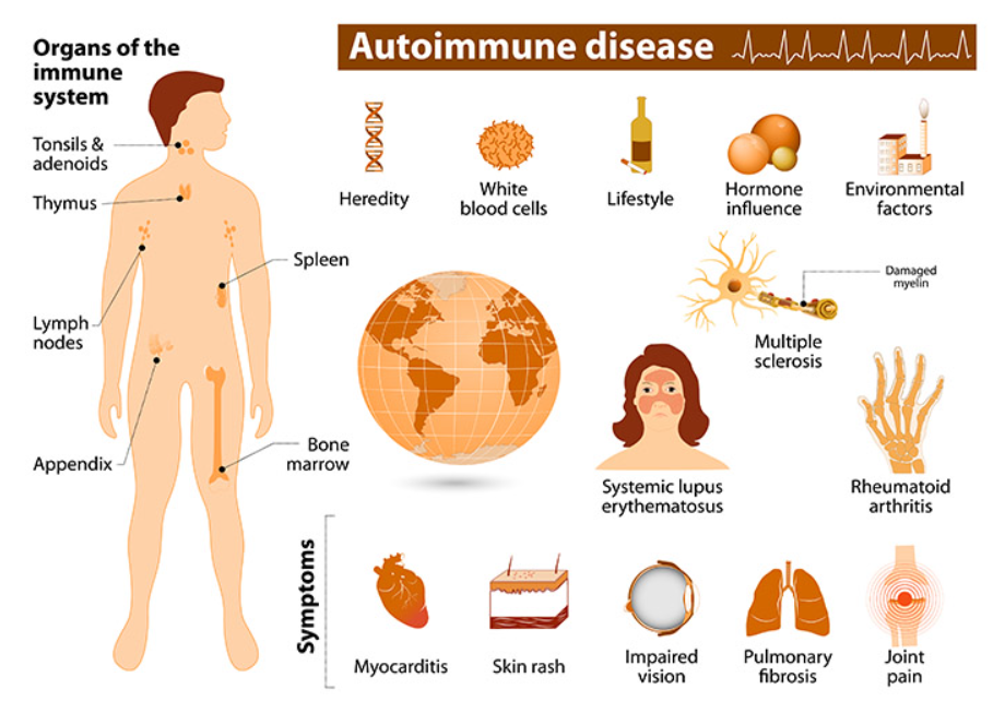 Autoimmune Disease