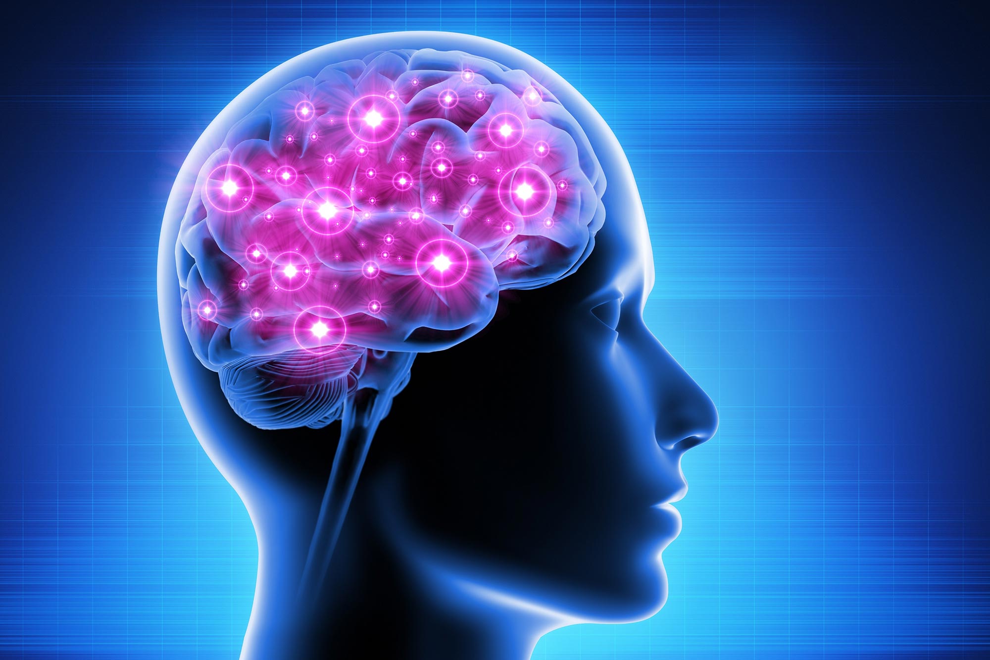 Brain Health Brain Health